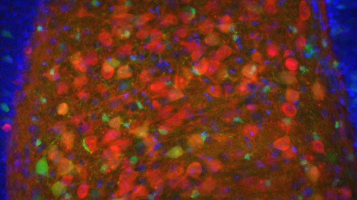 Densely packed cell nuclei under the microscope — the compartment nuclear-targeted delivery aims to reach; a Panacea Bio Chem technical brief by Bogdan Dicoias
